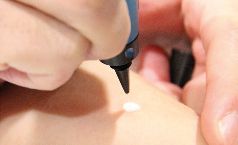 Workshop Cryopen